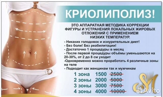 Криолиполиз