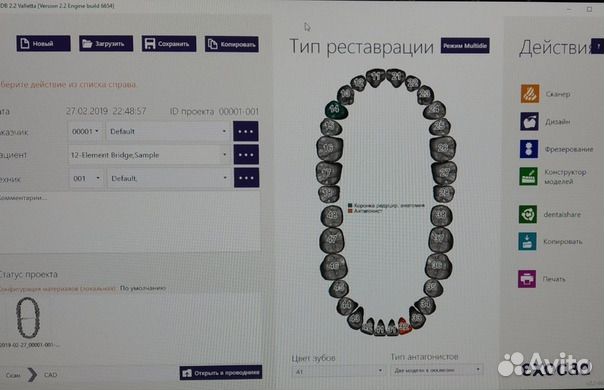Установка Exocad