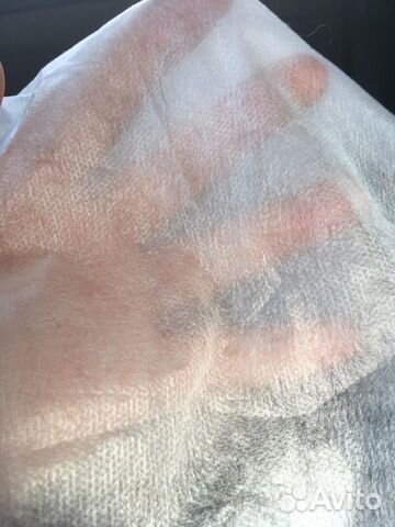 Смс, Мельтблаун, Спанбонд