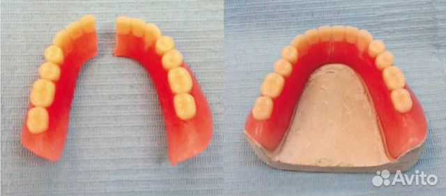 Пластиночный протез этапы. Этапы Починки съемного пластиночного протеза. Починка перелома базиса самотвердеющей пластмассой. Починка съемных пластиночных протезов. Частичный съемный пластиночный протез на нижнюю челюсть.